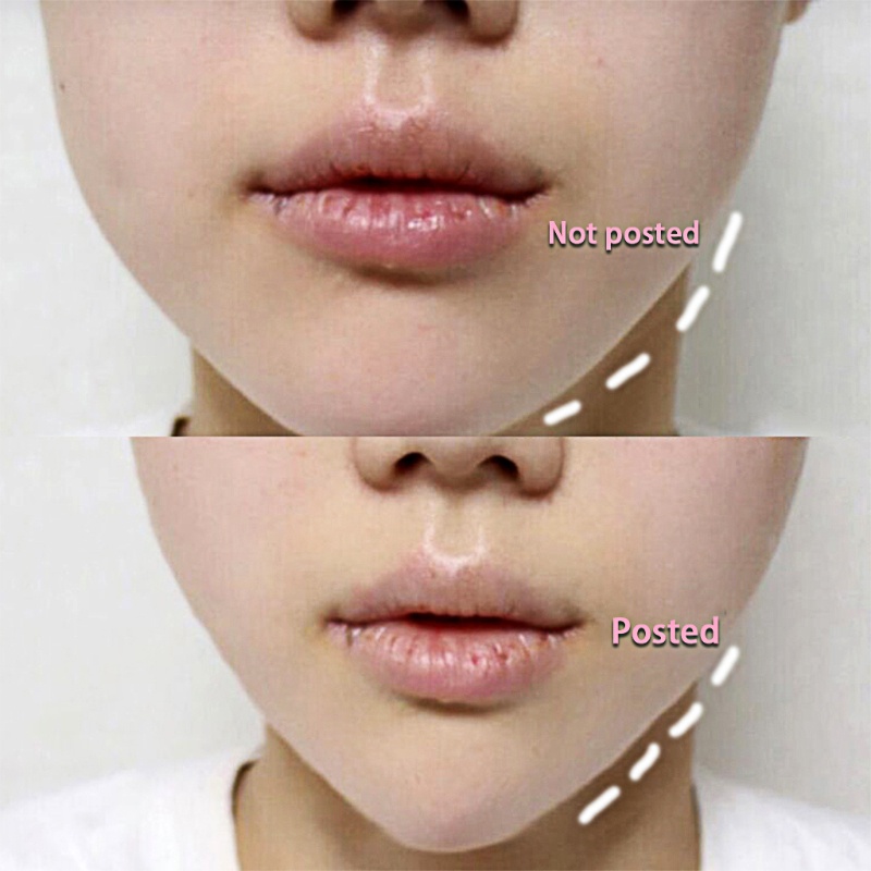 Set 40 Miếng Dán Tạo Khuôn Mặt Chữ V Vô Hình Nhanh Chóng YOUYO