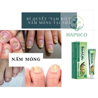 Kem Bôi Da Bách Liễu