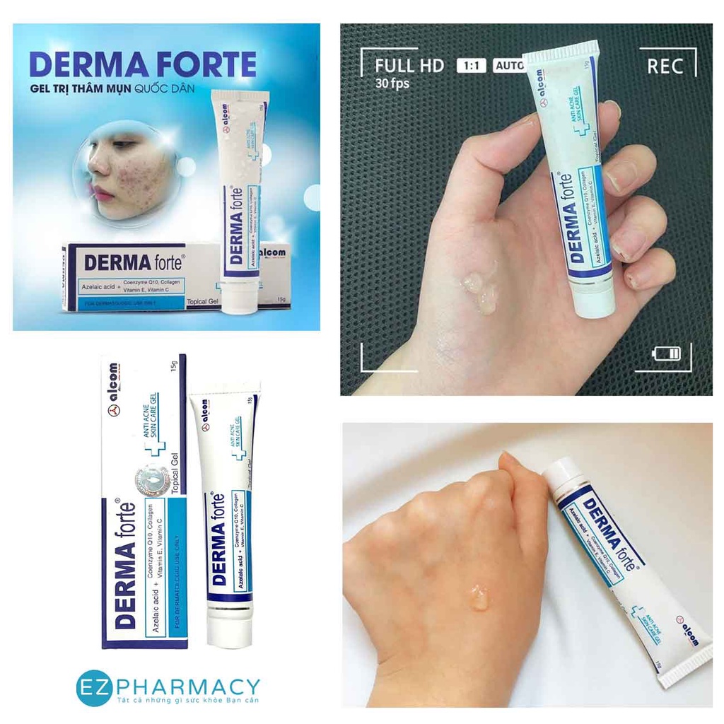 Derma Forte - Kem Giảm Mụn Ngừa Thâm Trứng Cá Dưỡng Sáng Da, Mụn Ẩn, Mụn Đầu Đen - 15g (bản thường)