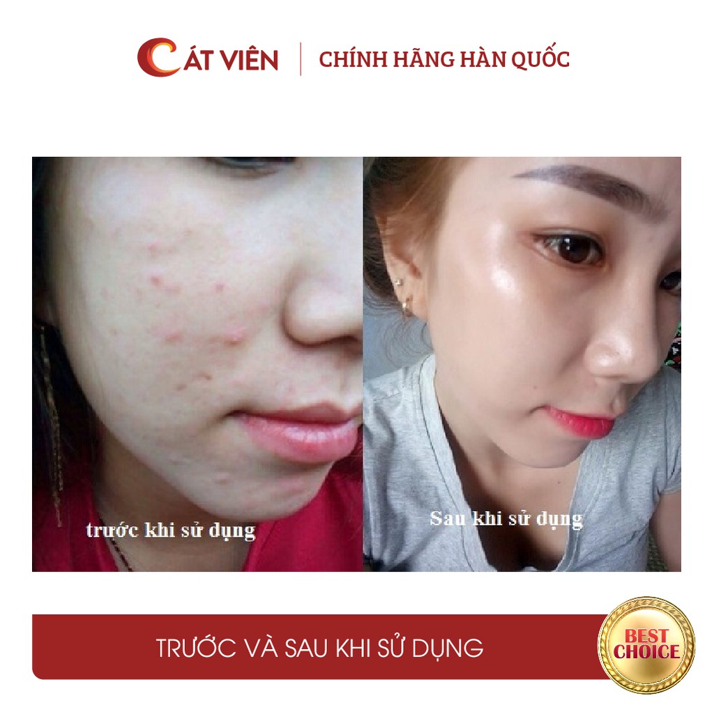 Tế bào gốc, serum kiềm dầu, cải thiện mụn, sẹo mụn, làm trắng Plantex Saffron Medicell Hàn Quốc hộp 10 lọ