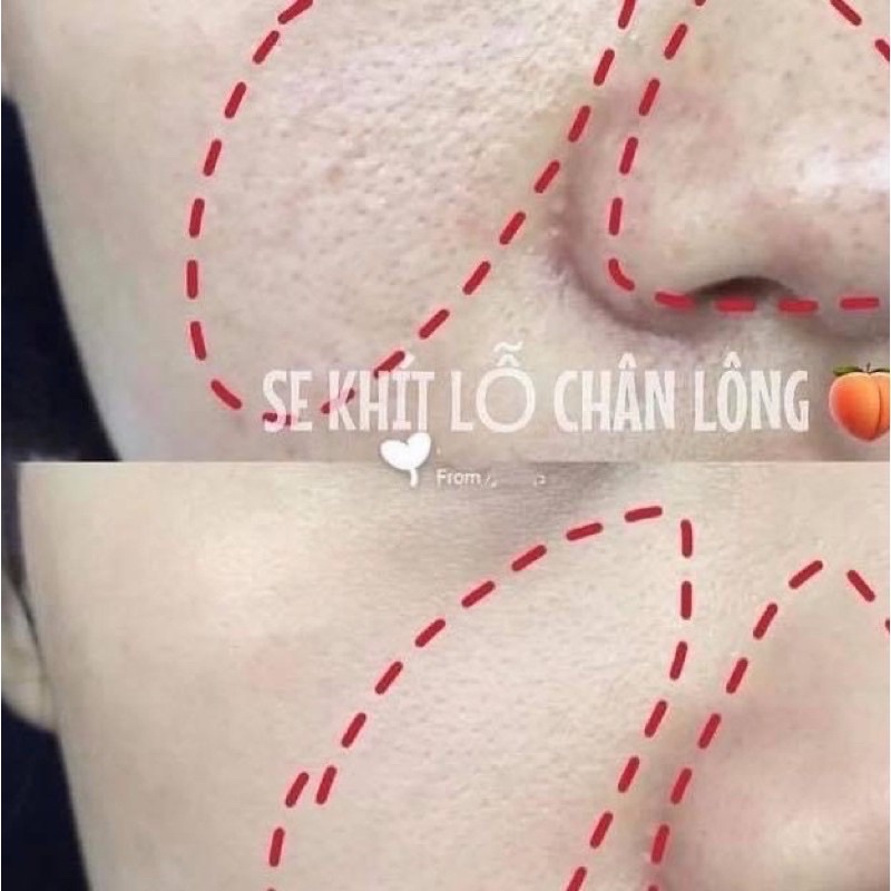 TONER SE KHÍT LỖ CHÂN LÔNG PORE | BigBuy360 - bigbuy360.vn