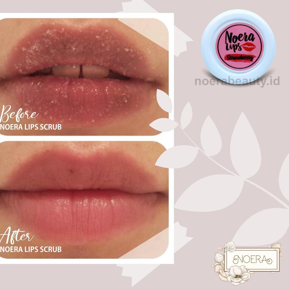 (Hàng Mới Về) Serum Tẩy Tế Bào Chết Môi Không Gây Dị Ứng Pros3Sz | BigBuy360 - bigbuy360.vn