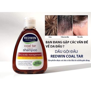dầu gội redwin giảm gàu, nấm, vảy nến, bã nhờn...