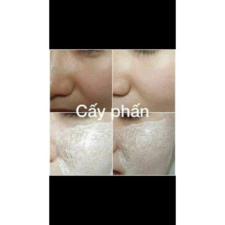 CẤY PHẤN MESOWHITE - HỘP 10 ỐNG