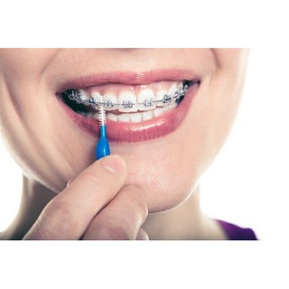 ✔️️️Bàn Chải Kẽ Răng - 1 chiếc - Dùng cho người chỉnh nha, nẹp răng
