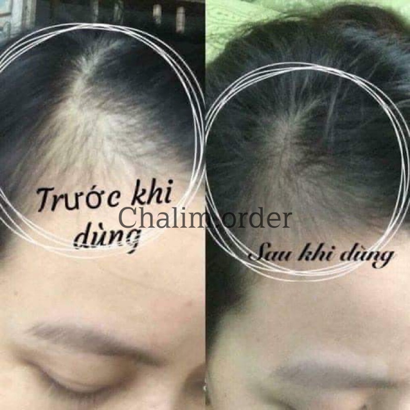 VIÊN HỖ TRỢ MỌC TÓC NỘI ĐỊA ĐỨC MIVOLIS 60 VIÊN TRẢ ORDER