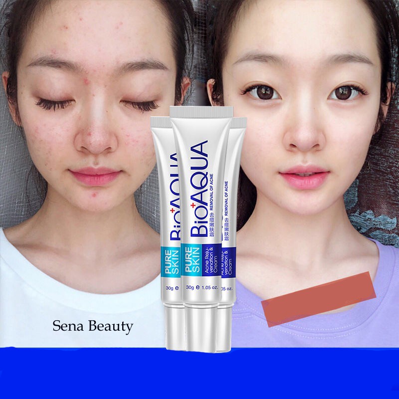 Kem dưỡng dành cho da mụn Bioaqua Pure Skin Senabeauty