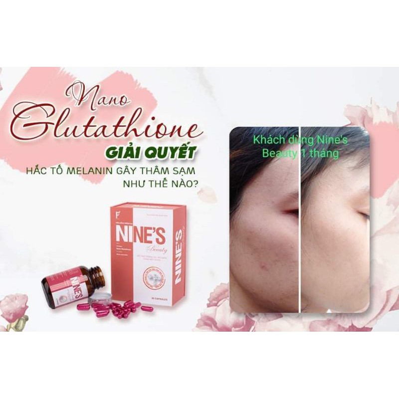 [Hàng Chính Hãng]Viên Uống Trắng Da Nine's Beauty | Thế Giới Skin Care