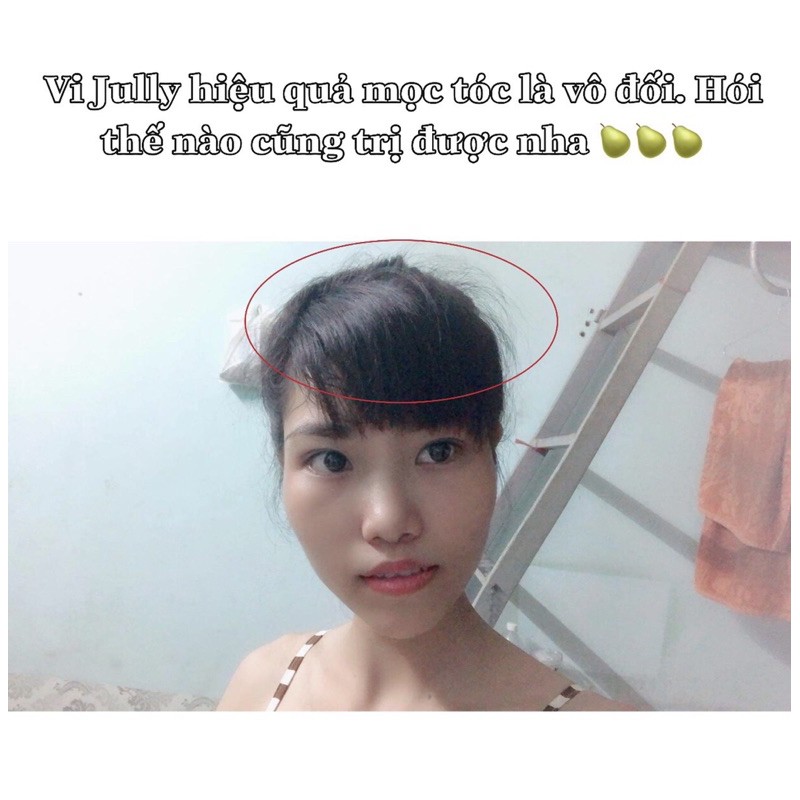 [GIẢM RỤNG 100%] Tinh Dầu Bưởi KÍCH THÍCH MỌC TÓC Vi Jully - Giảm Rụng Tóc - Kích Thích Mọc Tóc - Làm Dài Tóc | BigBuy360 - bigbuy360.vn