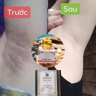 Siêu dưỡng thâm biho Ladi 5s