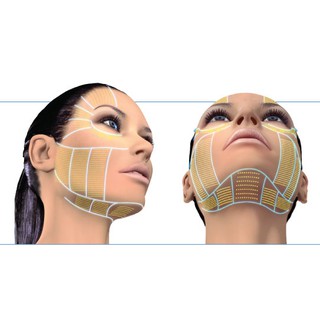 Máy Nâng Cơ Trẻ Hóa Da Hifu V-MAX