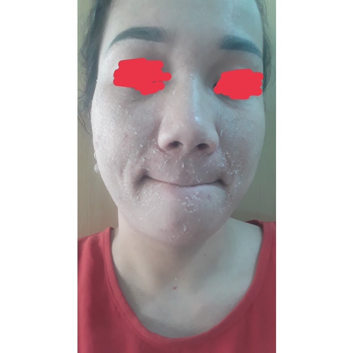 Thay Da Sinh Học HERBAL PEEL Công Nghệ Nhật Bản - Tái Sinh Làn Da Mới Đẹp Sau 7 Ngày | BigBuy360 - bigbuy360.vn
