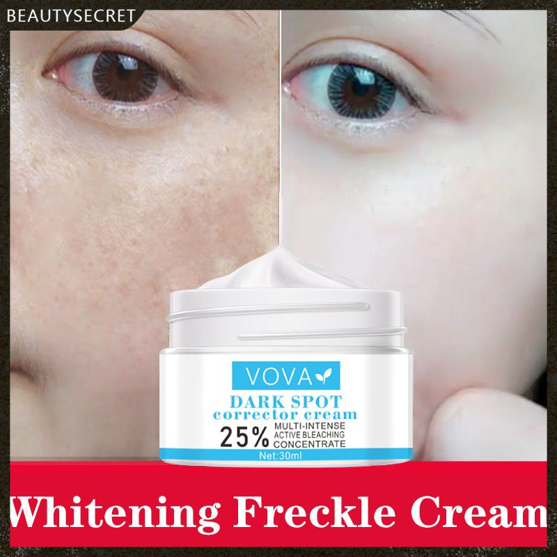 VOVA Effective Whitening Freckle Cream Remove Melasma Acne Spot Pigment Melanin Dark Spots Pigmentation Moisturizing Gel Skin Care -beauty