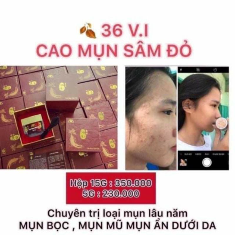 CAO MỤN SÂM ĐỎ 15gr - Chính Hãng 100%