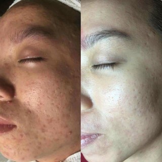 Thảo dược tái tạo da Teather Life