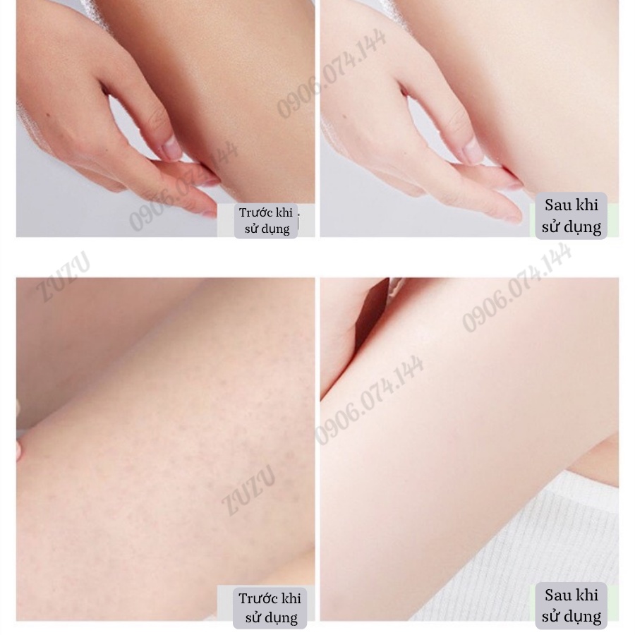 Tẩy tế bào chết, Tẩy Da Chết Body cải thiện da viêm lông sáng da Zu Cosmetic | BigBuy360 - bigbuy360.vn