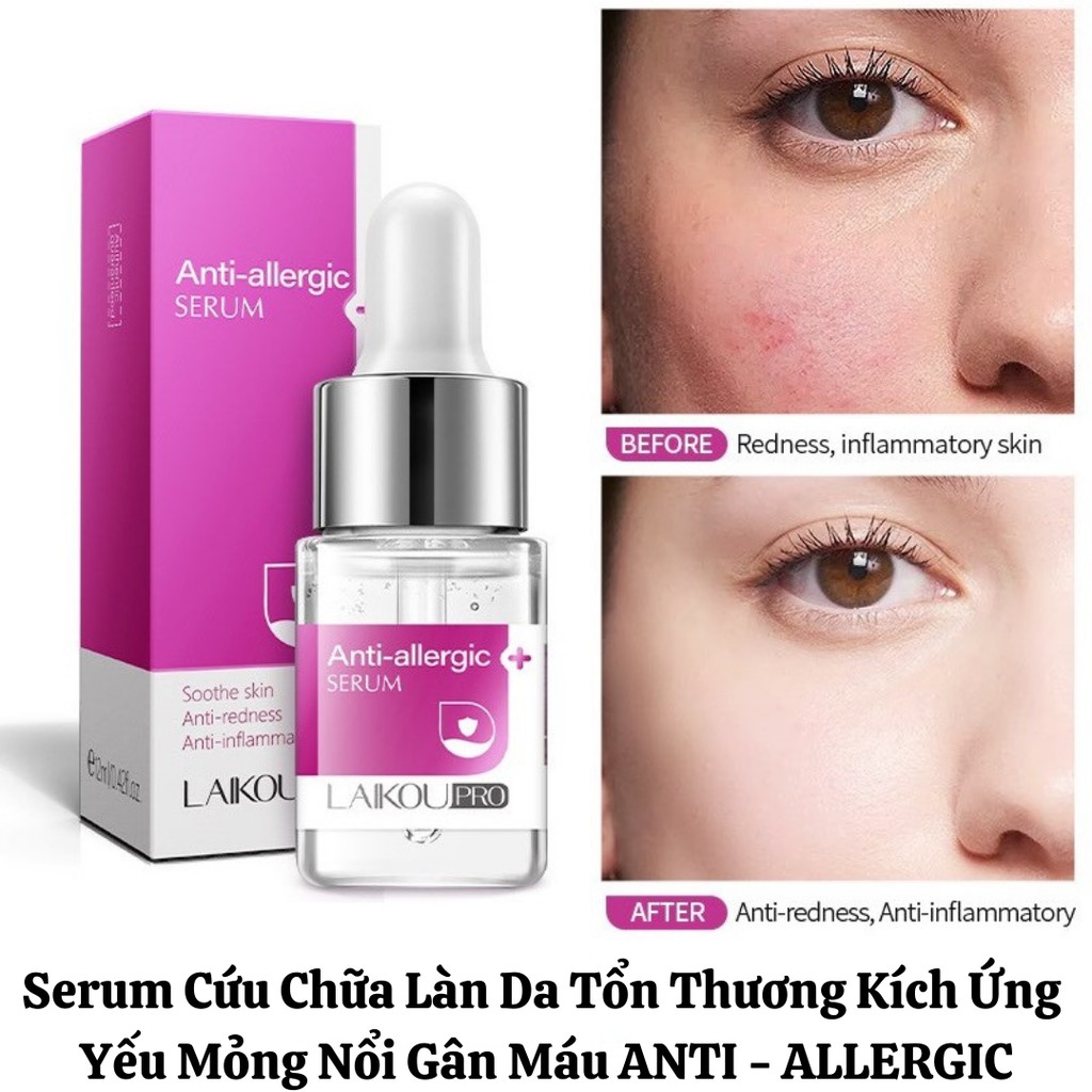 Serum Dưỡng Da Bị Kích Ứng Yếu Mỏng Dãn Mao Mạch