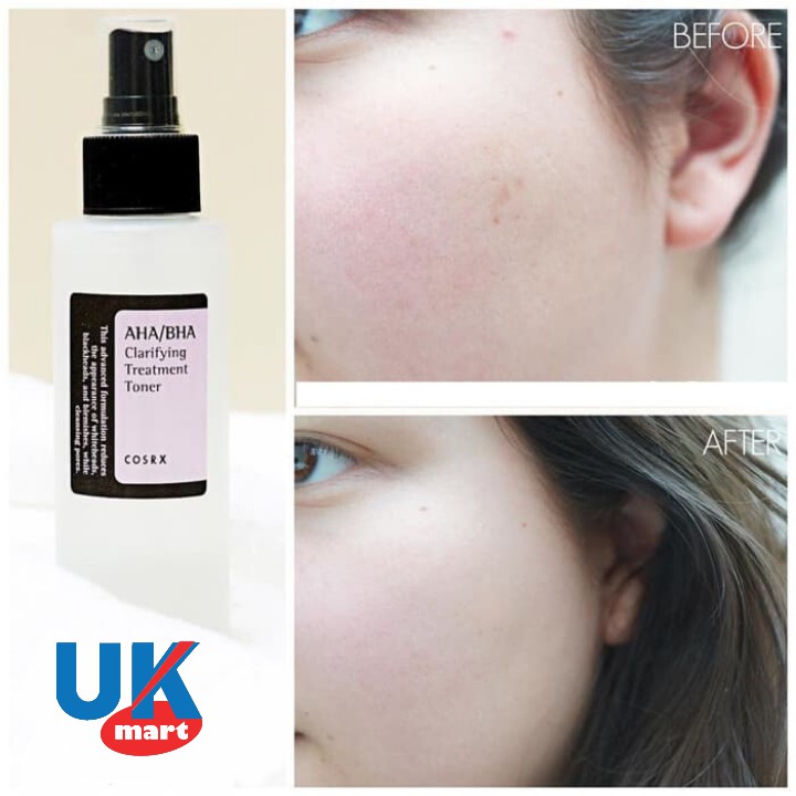 Nước Hoa Hồng Cosrx AHA BHA Clarifying Treatment, Centella Water Acohol Free Toner 150ml | BigBuy360 - bigbuy360.vn