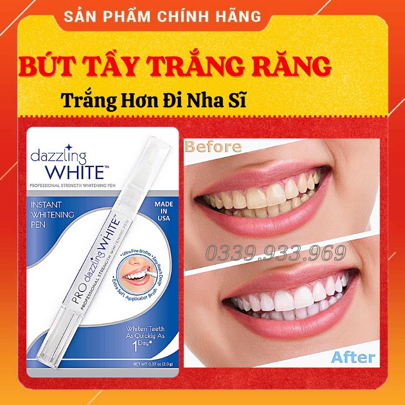 Bút Tẩy Trắng Răng Dazzling White