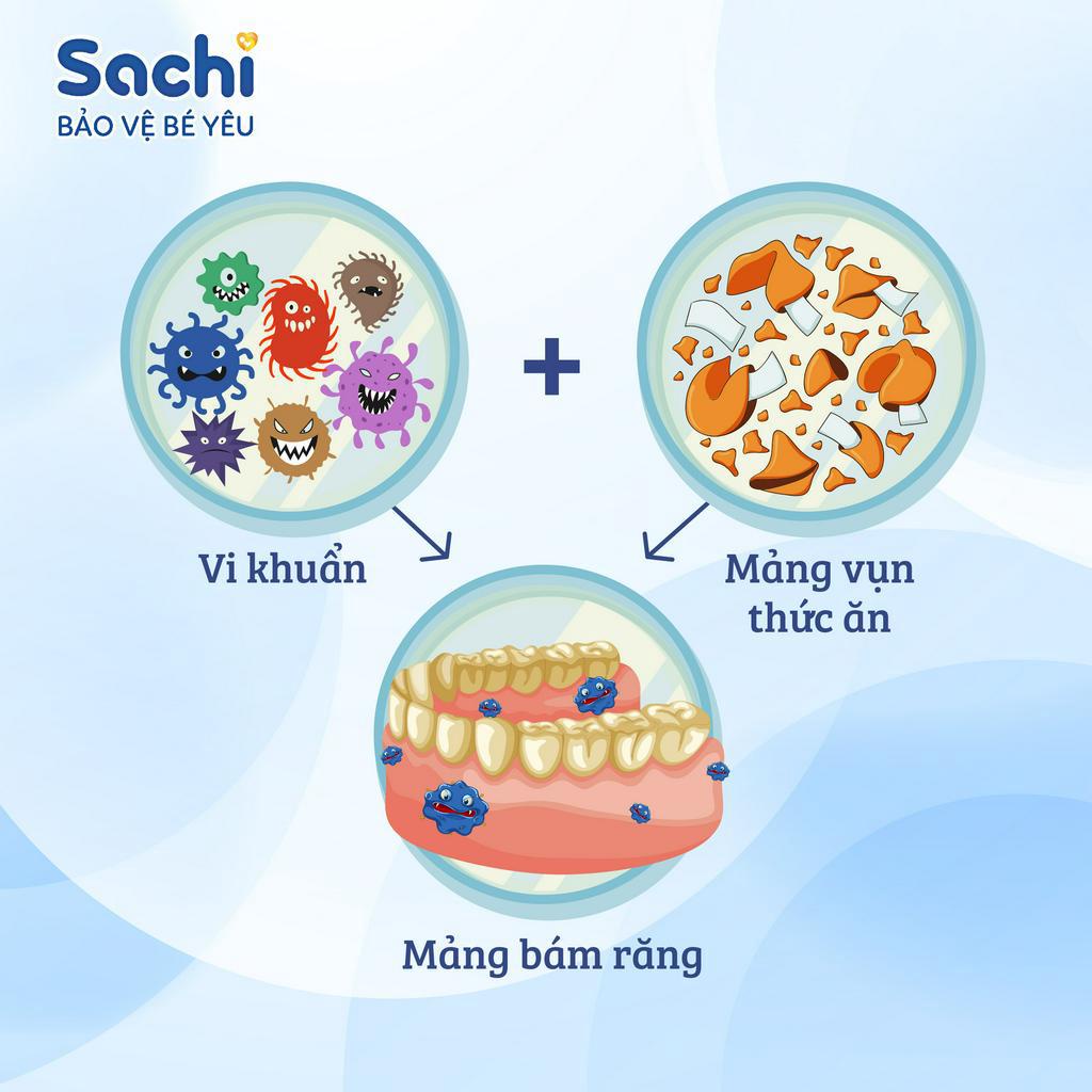 Xịt Chống Sâu Răng Cho Bé SACHI Giảm Hôi Miệng Mang Lại Hơi Thở Thơm Mát, Ngăn Ngừa Mảng Bám Chai 30ml