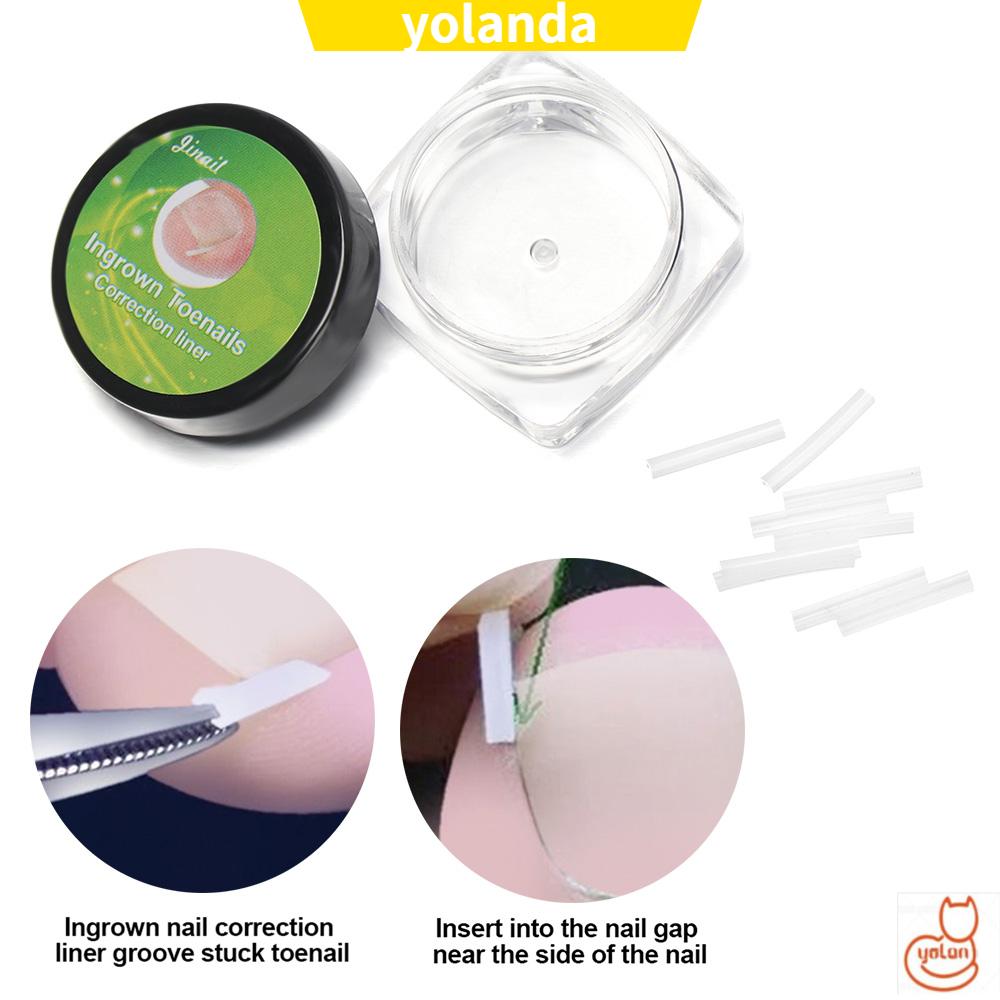 [Hàng mới về] Hộp dụng cụ kẹp thẳng điều chỉnh móng chân mọc ngược chống dị ứng tiện lợi