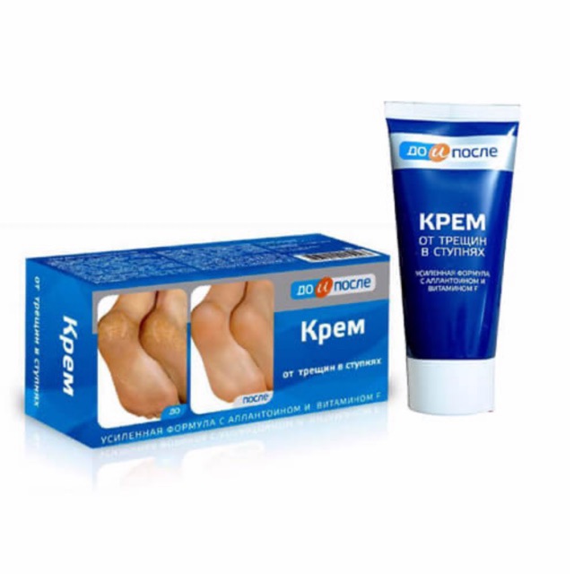 Kem giảm nứt gót chân Kpem Apteka của Nga 50ml