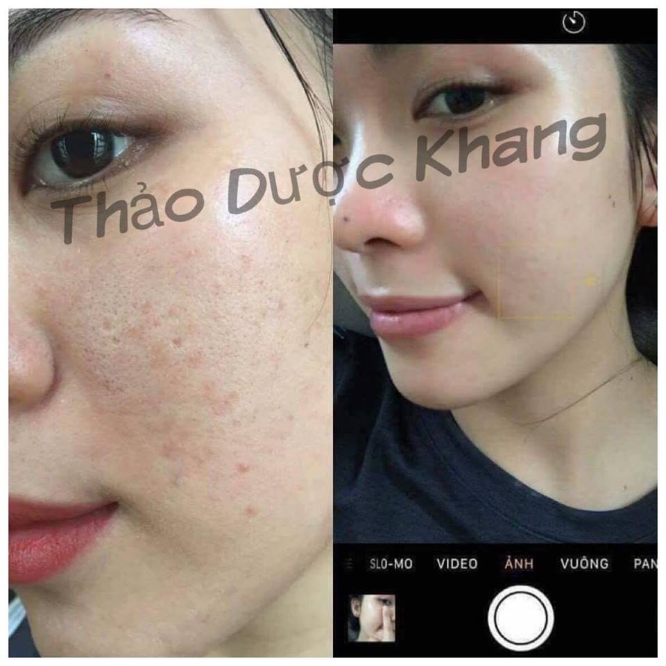 Bột thảo dược ủ trắng chăm sóc dưỡng sáng và phụ hồi da cao cấp Thảo Dược Khang - TDK SKIN