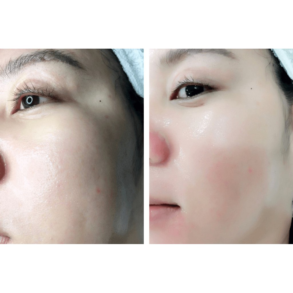 [AUTH] Tinh chất làm trắng se khít lỗ chân lông MEDI PEEL BIO INTENSE GLUTHION 600