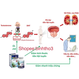 BONIMEN - HỖ TRỢ ĐIỀU TRỊ PHÌ ĐẠI TUYẾN TIỀN LIỆT, viêm đường tiết niệu