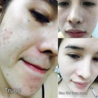 Thay da mặt tảo biển Cozy
