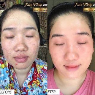 Kem face pháp A Cosmetics ( chính hãng )