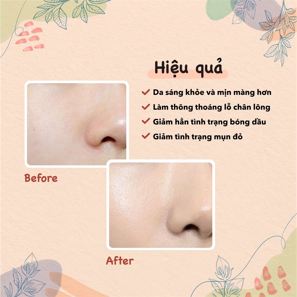 Sữa rửa mặt ngừa mụn dịu nhẹ tràm trà dạng gel Themis Tea Tree Cleansing Gel 100ml | BigBuy360 - bigbuy360.vn