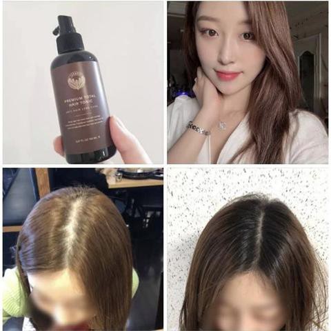 Sữa Dưỡng Tóc Total Hair Tonic 150ml X