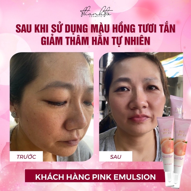 Kem Dưỡng Má Hồng Môi - Ti Hồng Thanh Tô - Pink Emulsion ( Chính Hãng 100%)