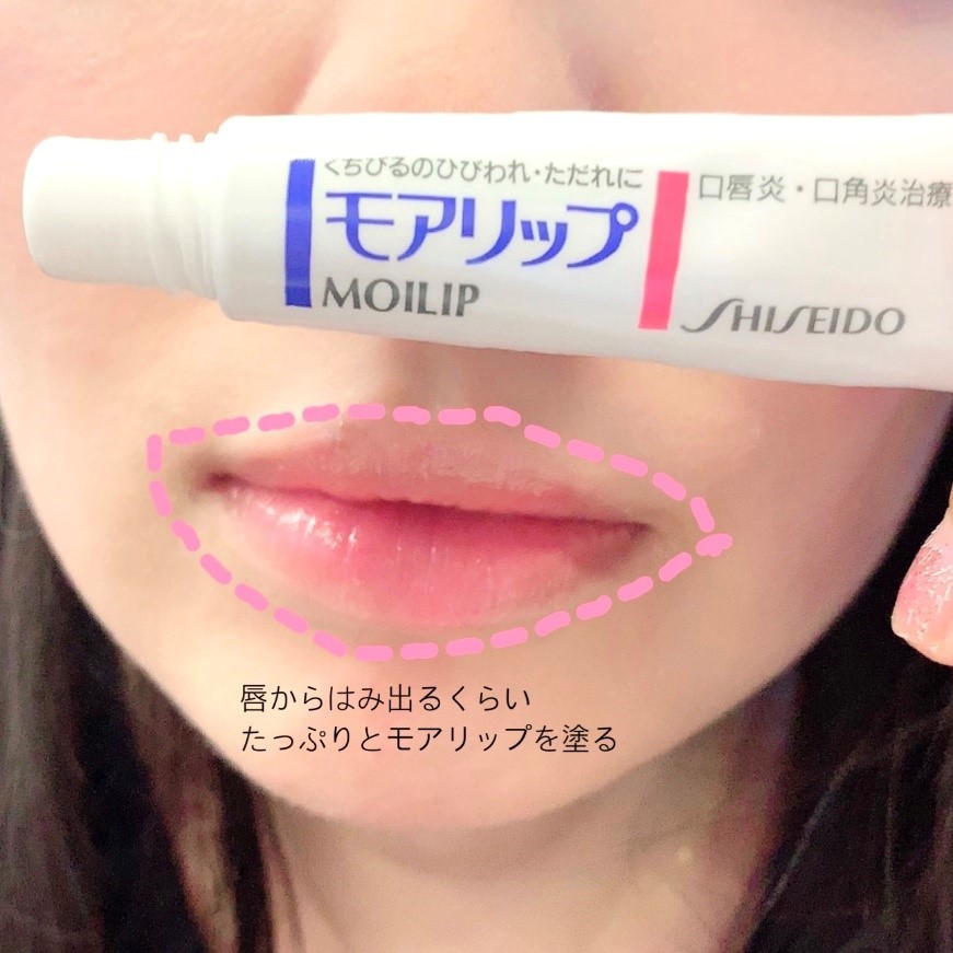 Son Dưỡng Môi Moilip Shiseido Nhật Bản