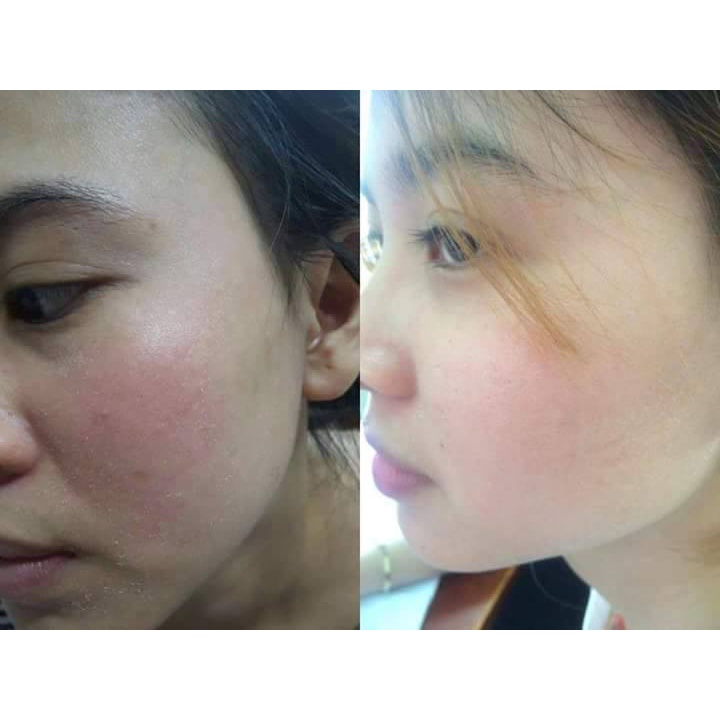 (Tặng kèm bột rửa mặt) Kem đông y tái tạo nhân sâm sạch mụn nám tráng hồng căng bóng