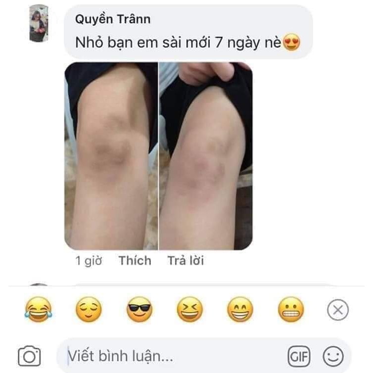 Kem thâm nách ol cell ( cam kết chuẩn 100%, chỉ bán loại 1) | BigBuy360 - bigbuy360.vn