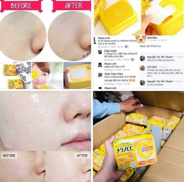 Mặt nạ trắng da trị thâm mụn2 | BigBuy360 - bigbuy360.vn