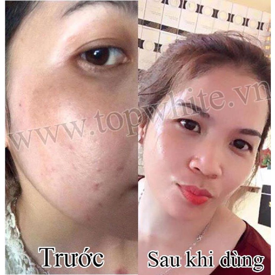 [TRỢ SHIP] Serum tạo sự căng bóng ngăn ngừa lão hóa da TopWhite White Perfect D6