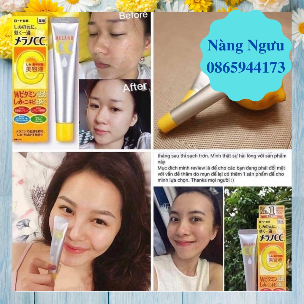 Serum Melano CC, Serum Cho Da Dầu Mụn Dưỡng Trắng, Ngăn Ngừa Mụn Và Chống Lão Hóa Da Hiệu Quả Số 1 Nhật Bản | BigBuy360 - bigbuy360.vn