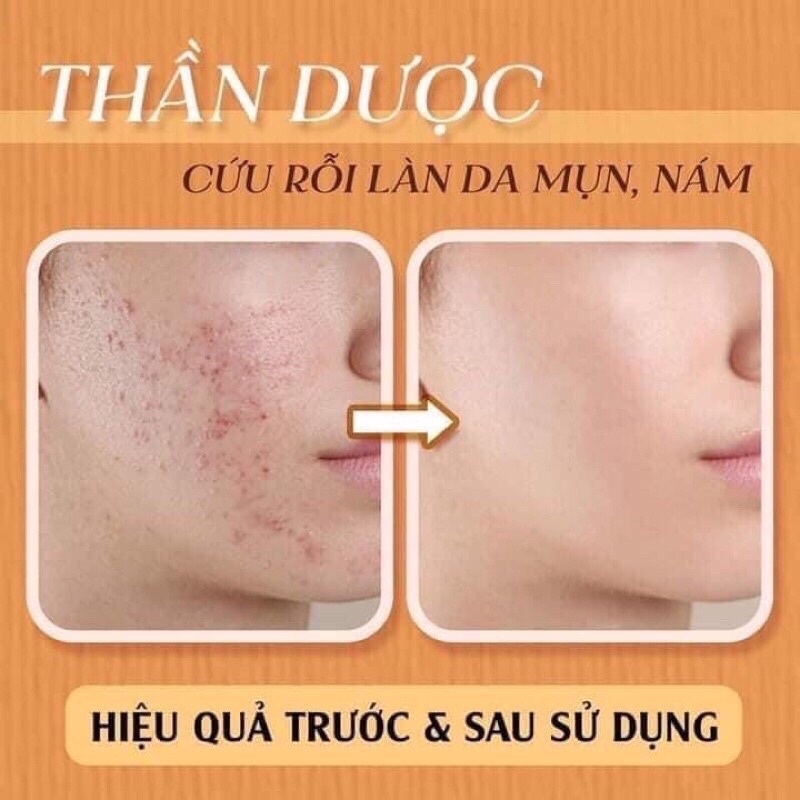 KV Beauty- Cốt huyết thanh thảo dược MEEA