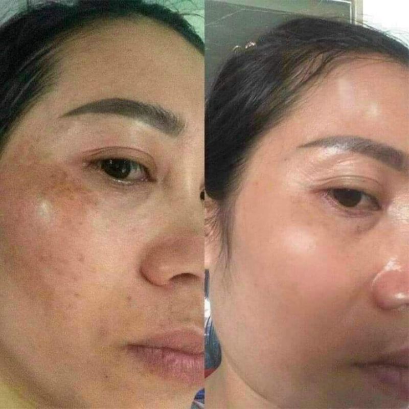 Kem Ngày Dakami K-White Chính Hãng Mua 2 Tặng 1