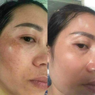 Serum Dakami Chính Hãng