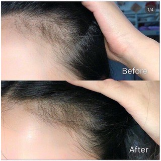 Thuốc mọc tóc sato