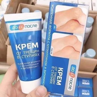 KEM TRỊ NỨT GÓT CHÂN NGA