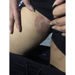 [shop yêu thích] Kem Bôi Da Lan Chi [siêu rẻ]
