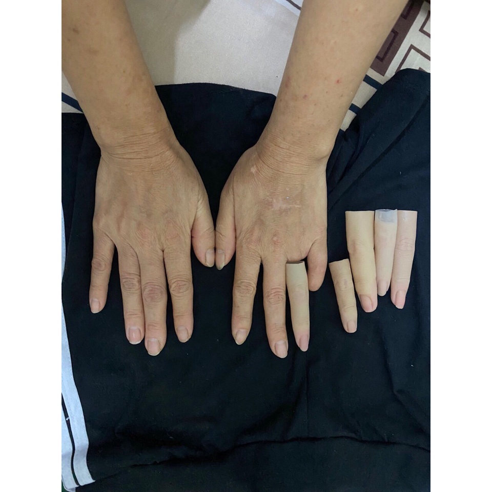 Ngón tay và bàn tay giả bằng silicone-MSP: BP0611