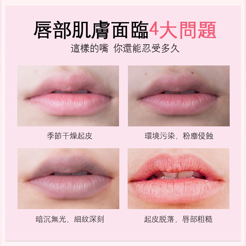 (hàng Mới Về) Mặt Nạ Môi Tinh Chất Thực Vật Dưỡng Ẩm Chăm Sóc Đôi Môi | BigBuy360 - bigbuy360.vn