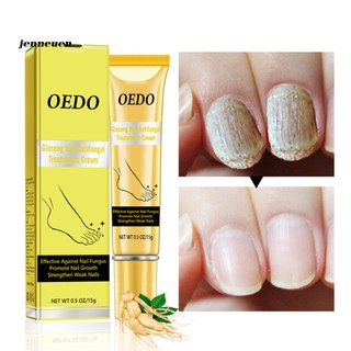 [Hàng mới về] Kem trị nấm bảo vệ và kích thích sự phát triển móng tay chân 15g