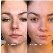 🌿 Toner Tẩy Da Chết Làm Sáng Da REN Clean Skincare Ready Steady Glow Daily AHA Toner